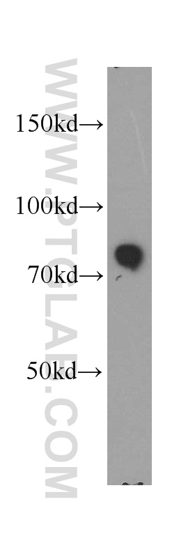 20661-1-AP;HEK-293 cells