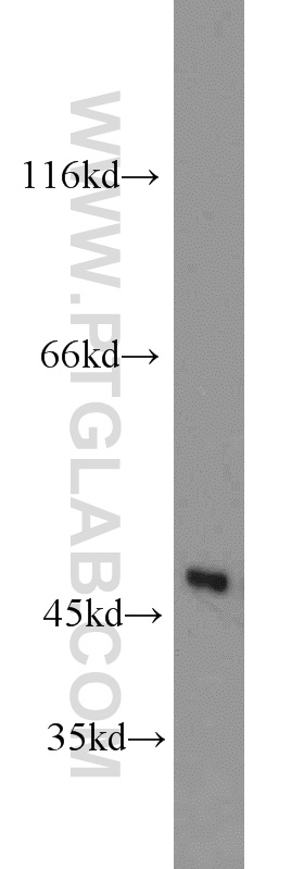 11422-1-AP;human brain tissue