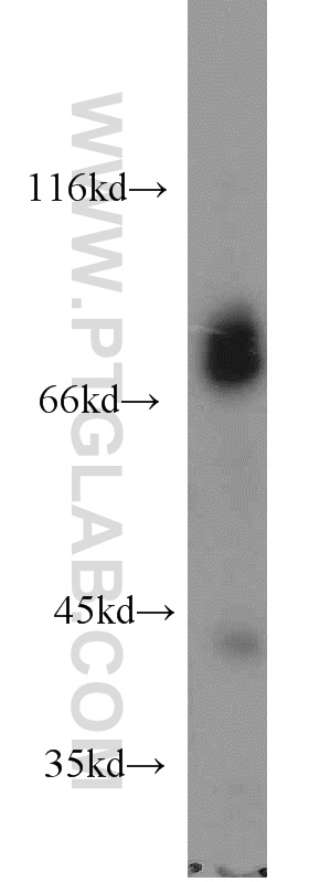 15492-1-AP;mouse brain tissue