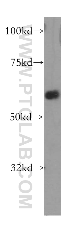 13515-1-AP;mouse kidney tissue