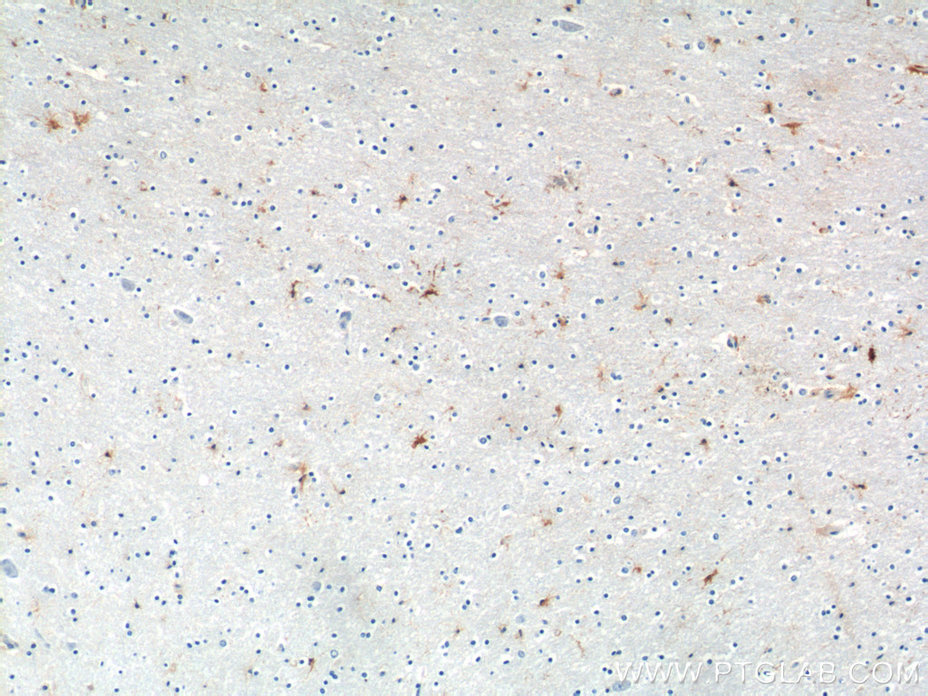 21029-1-AP;human brain tissue