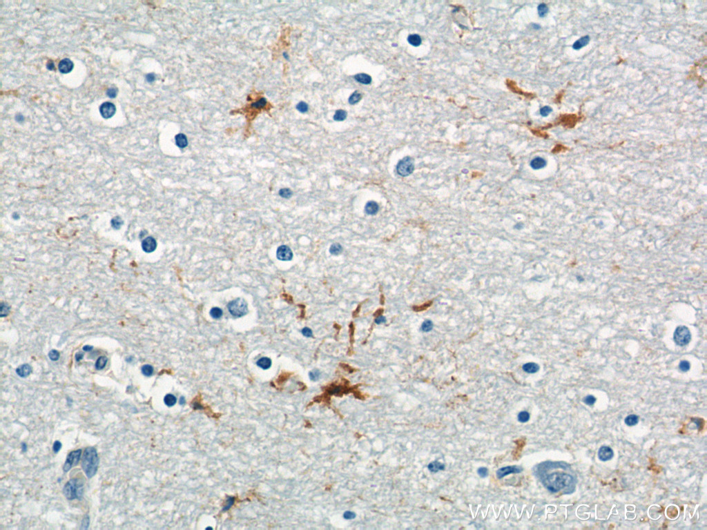 21029-1-AP;human brain tissue