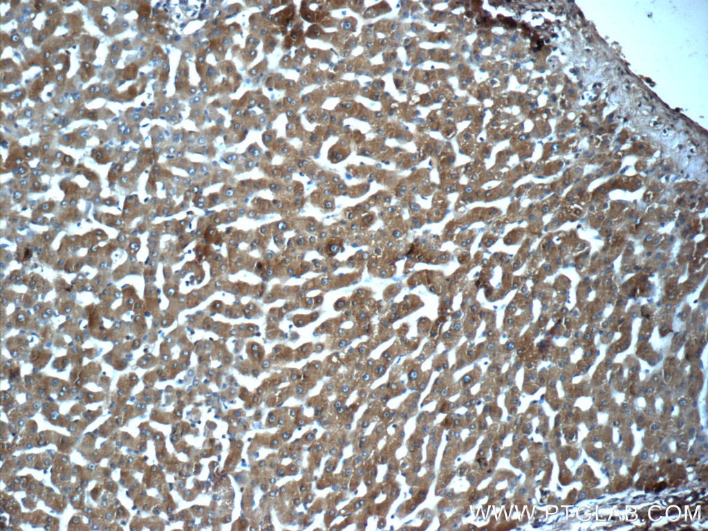 24207-1-AP;human liver tissue