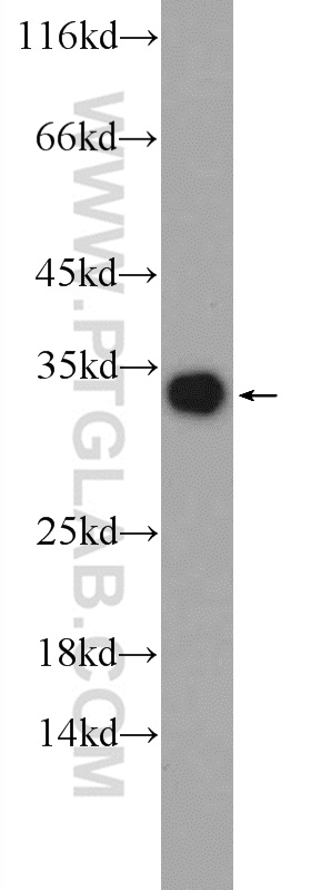 24207-1-AP;human blood tissue