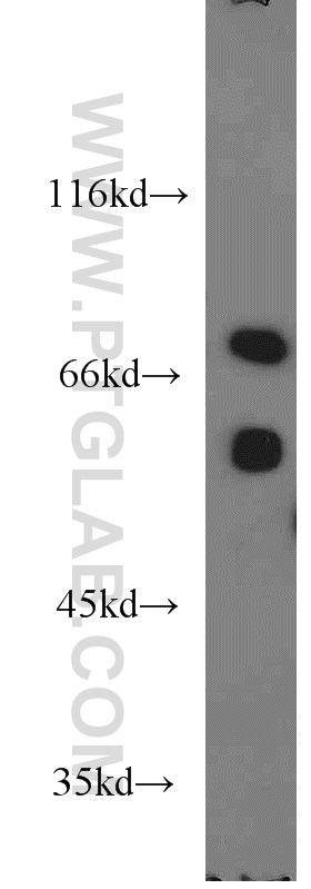 14861-1-AP;mouse liver tissue