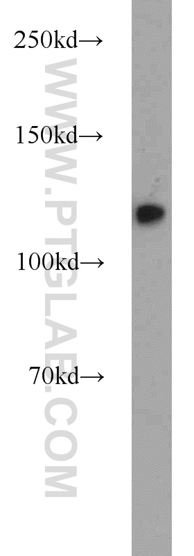 10513-1-AP;K-562 cells