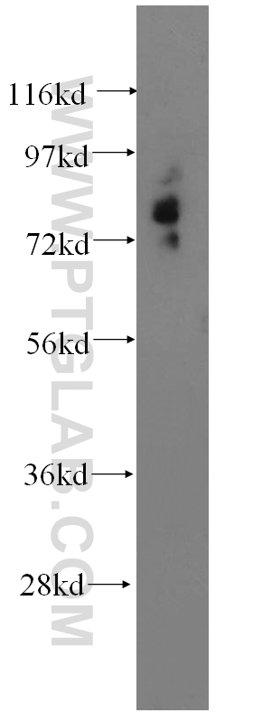 13879-1-AP;A375 cell