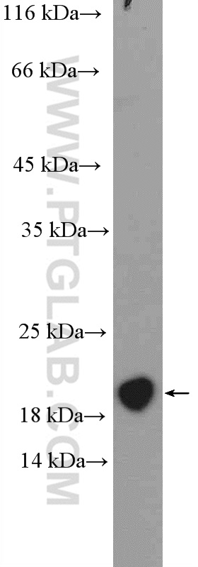 14984-1-AP;mouse bladder tissue