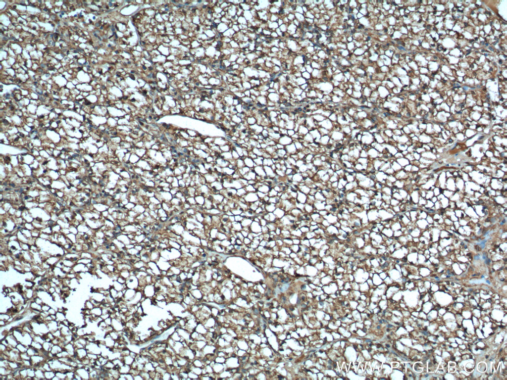 15904-1-AP;human renal cell carcinoma tissue