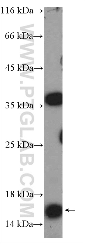 15196-1-AP;COLO 320 cells