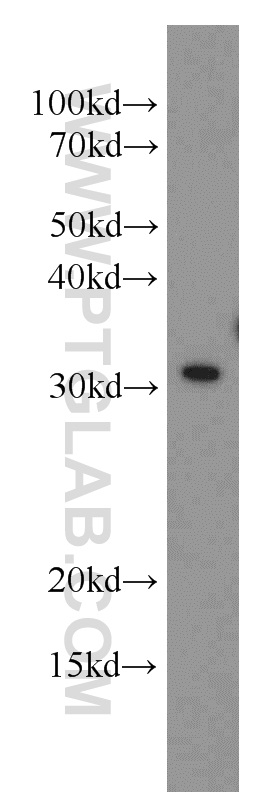 15338-1-AP;Jurkat cell