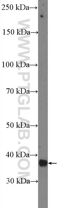 18710-1-AP;mouse skeletal muscle tissue