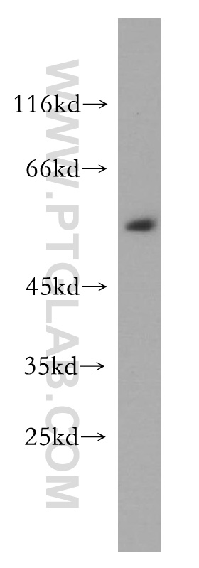 14604-1-AP;BxPC-3 cell