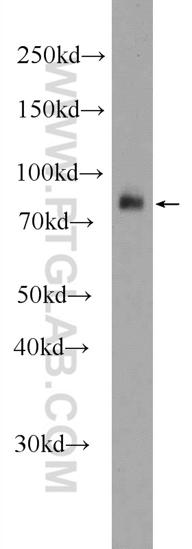 24640-1-AP;mouse kidney tissue