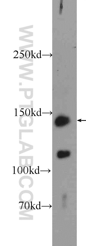 25869-1-AP;A431 cells