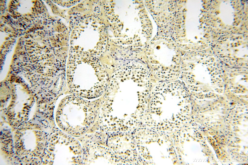 17040-1-AP;human testis