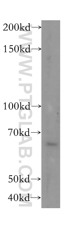 17040-1-AP;HepG2 cells