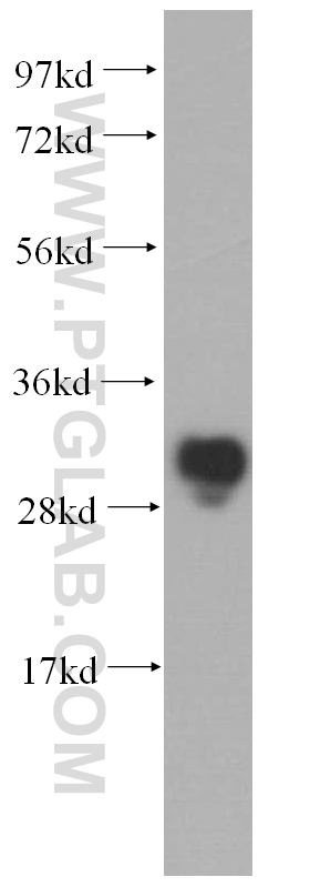 14994-1-AP;A2780 cell