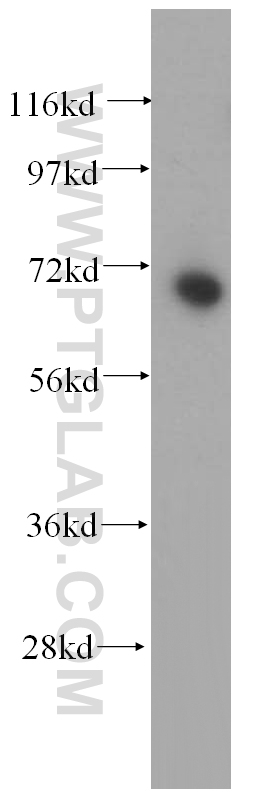 15073-1-AP;HEK-293 cells