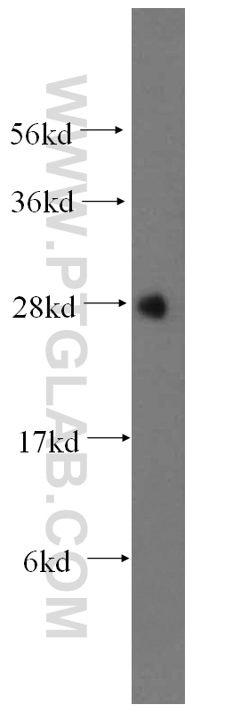 17001-1-AP;mouse liver tissue