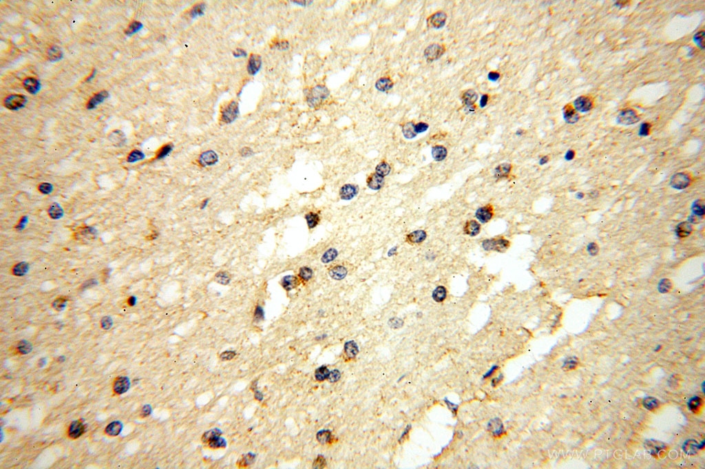 17090-1-AP;human brain tissue