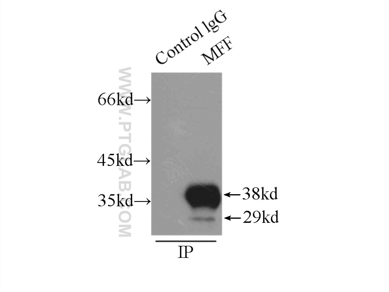 17090-1-AP;mouse brain tissue