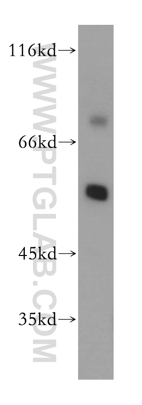 17841-1-AP;SH-SY5Y cell