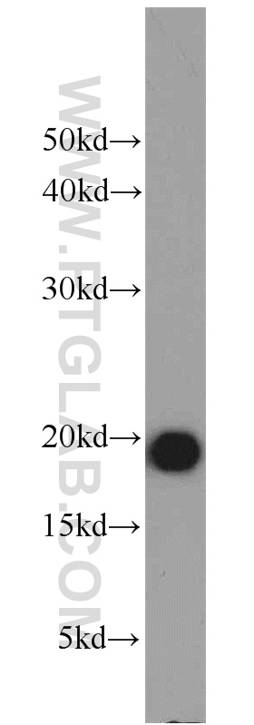 11454-1-AP;Raji cells