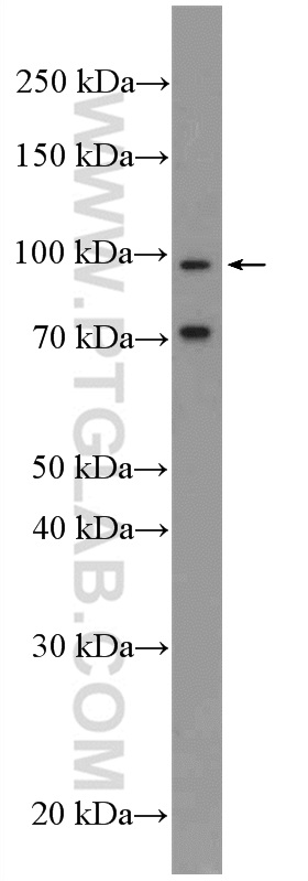 13965-1-AP;PC-3 cells