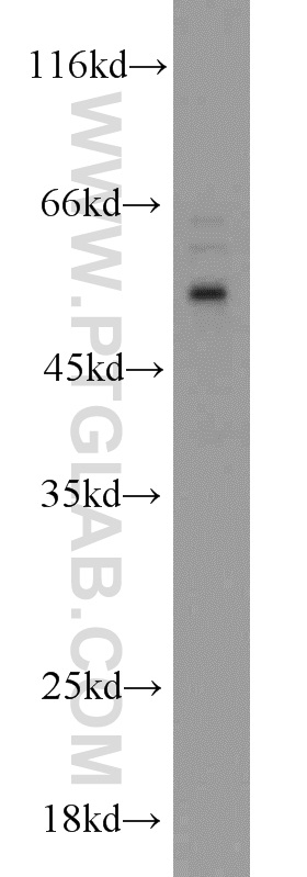 14158-1-AP;HepG2 cells