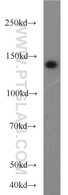 21166-1-AP;HepG2 cells