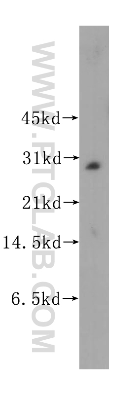 11835-1-AP;human brain tissue