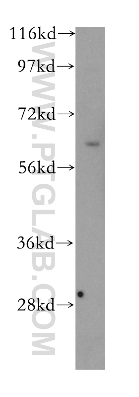 12825-1-AP;Jurkat cell