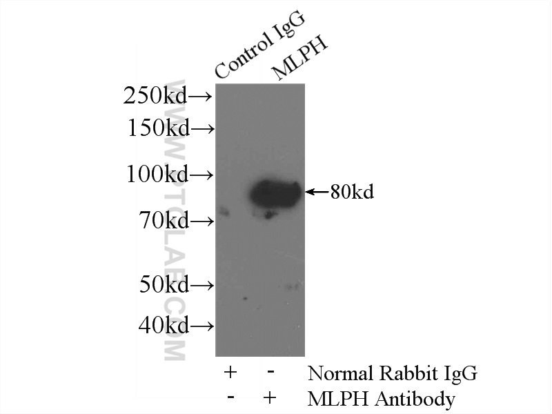 10338-1-AP;A375 cells