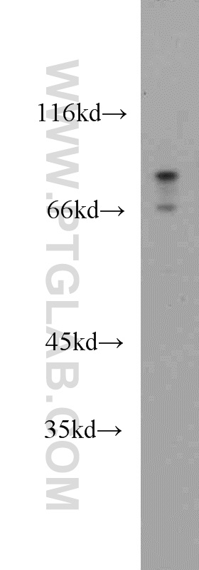 10338-1-AP;A375 cell