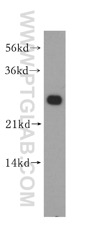 11137-1-AP;HeLa cells