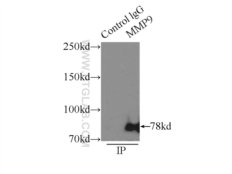 10375-2-AP;Jurkat cells