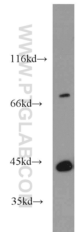 14234-1-AP;human brain tissue