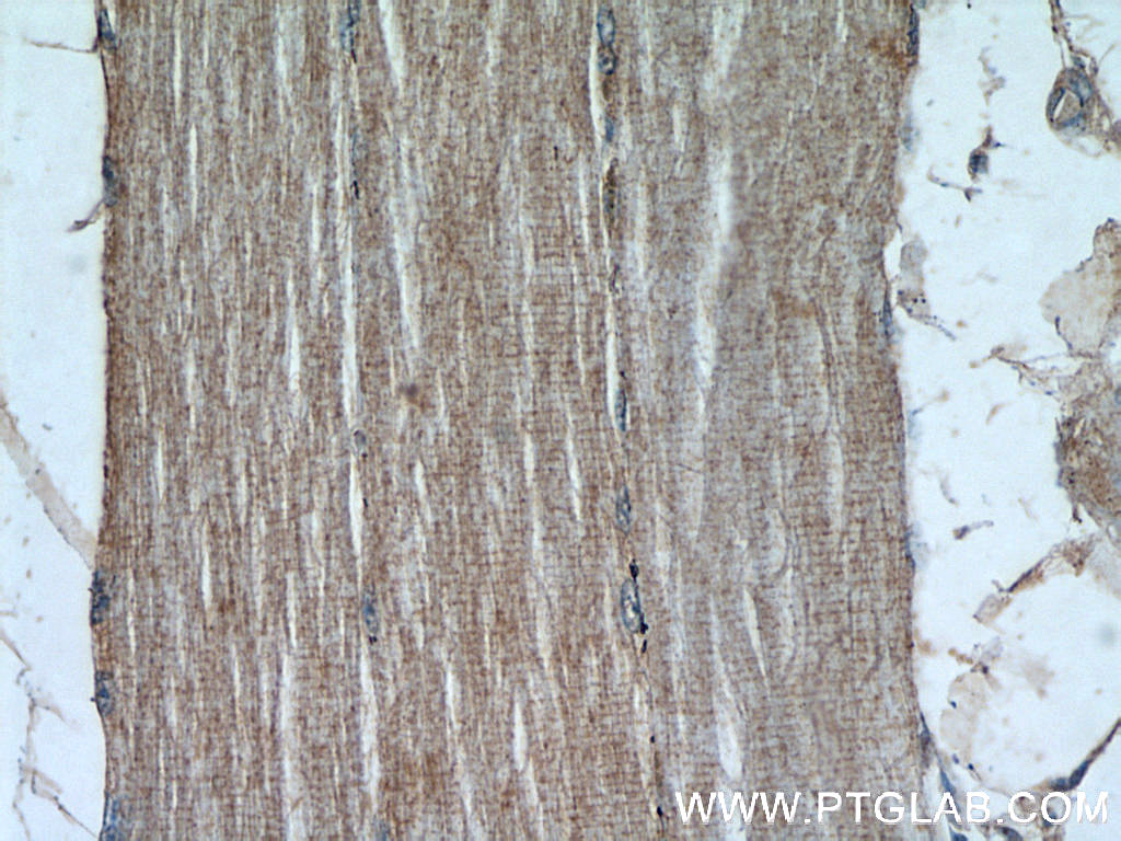 14213-1-AP;human skeletal muscle