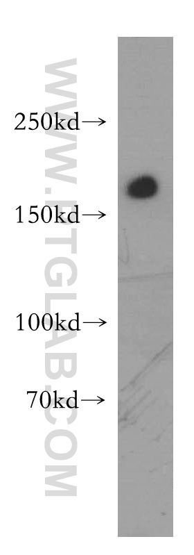 18704-1-AP;human kidney tissue