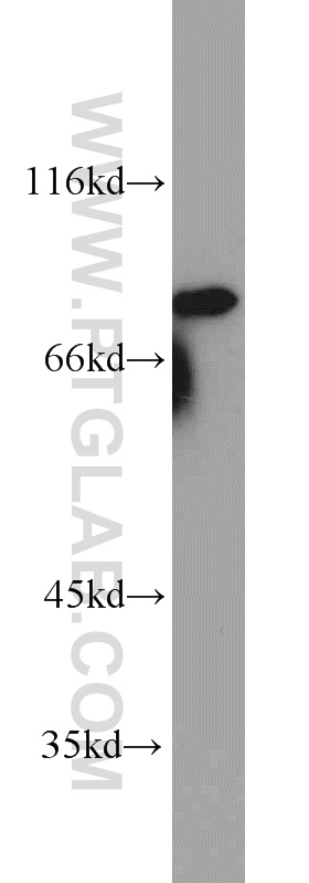 10744-1-AP;A431 cell