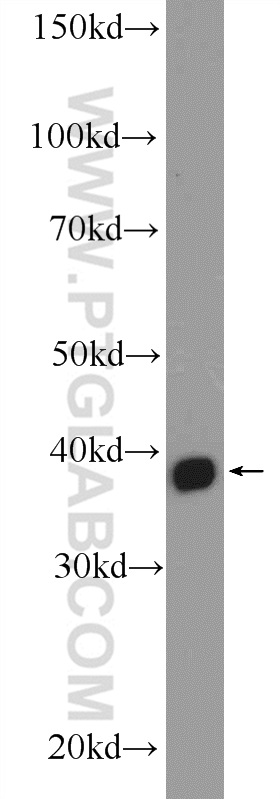 16392-1-AP;MCF-7 cells