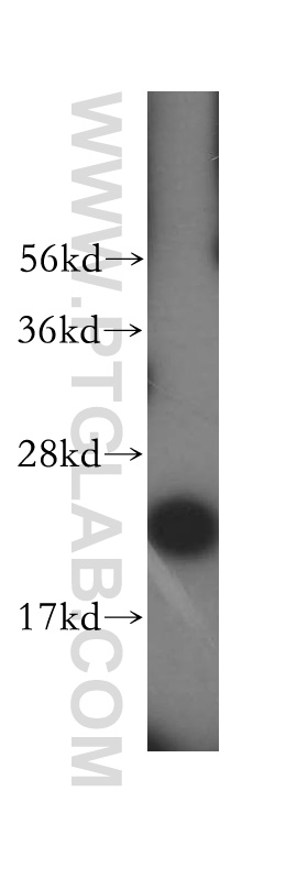 15543-1-AP;HepG2 cell