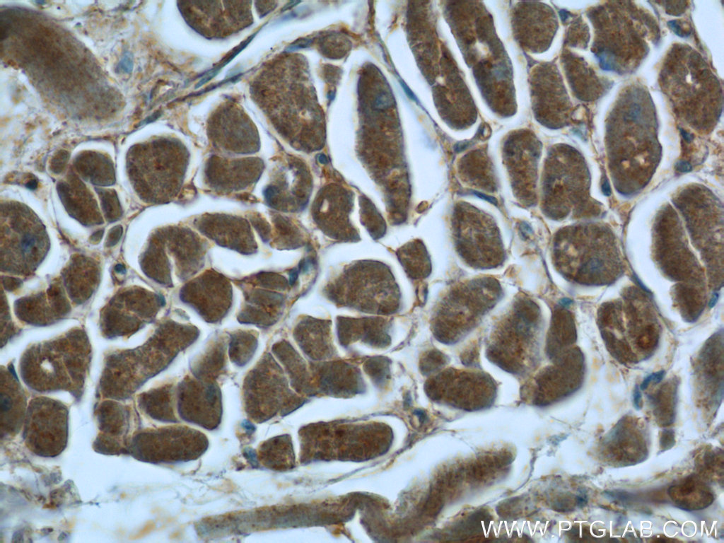 23870-1-AP;human heart tissue