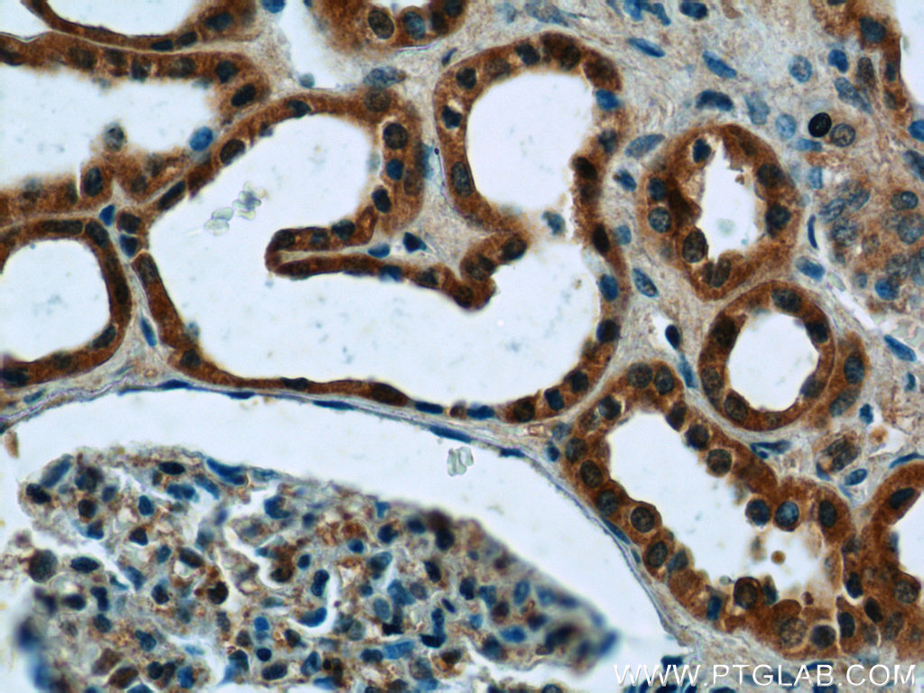 23870-1-AP;human kidney tissue