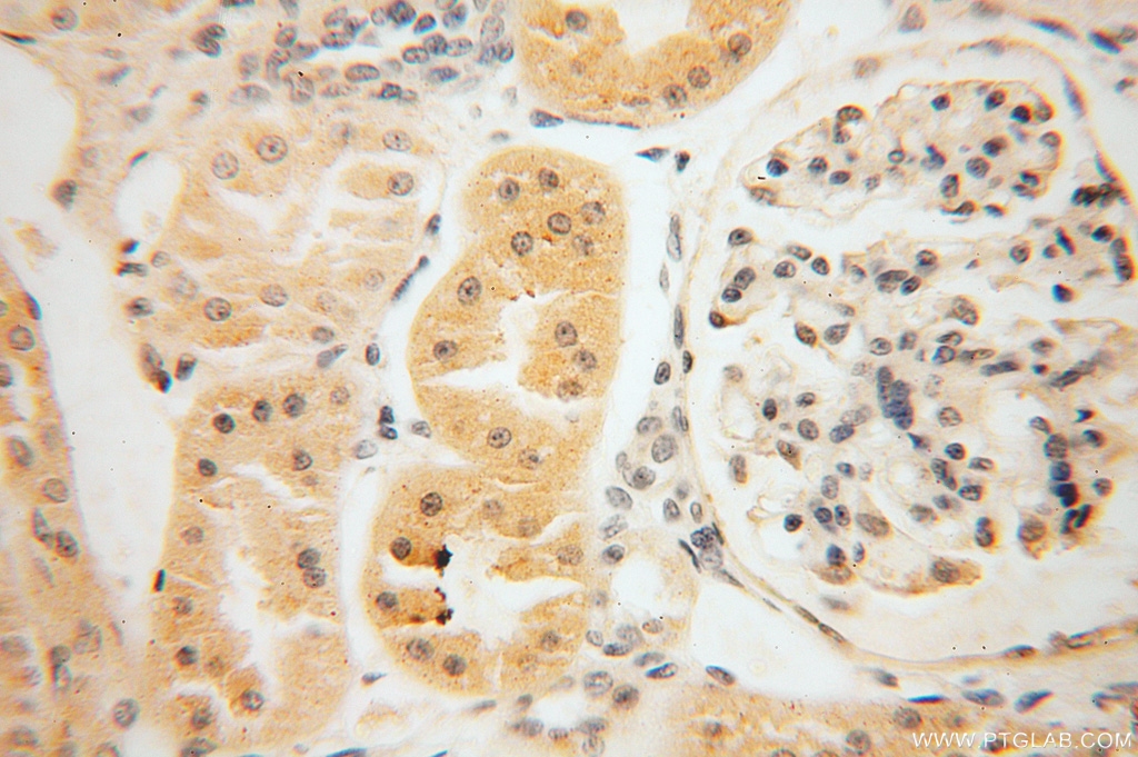 16279-1-AP;H-kidney(glomerulus)