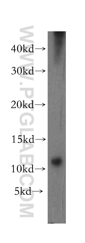 16279-1-AP;human kidney tissue