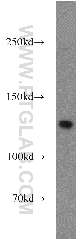 22393-1-AP;HeLa cell