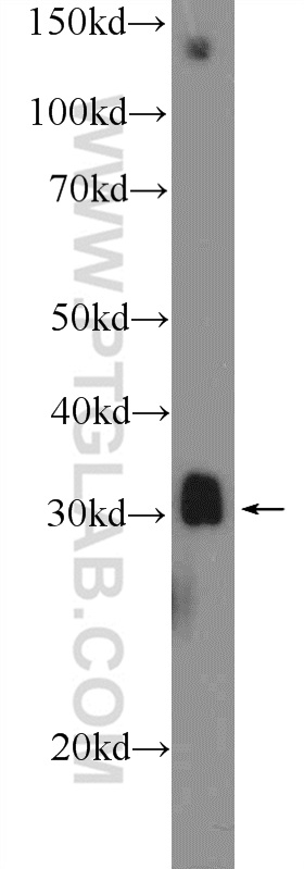 17678-1-AP;mouse skeletal muscle tissue