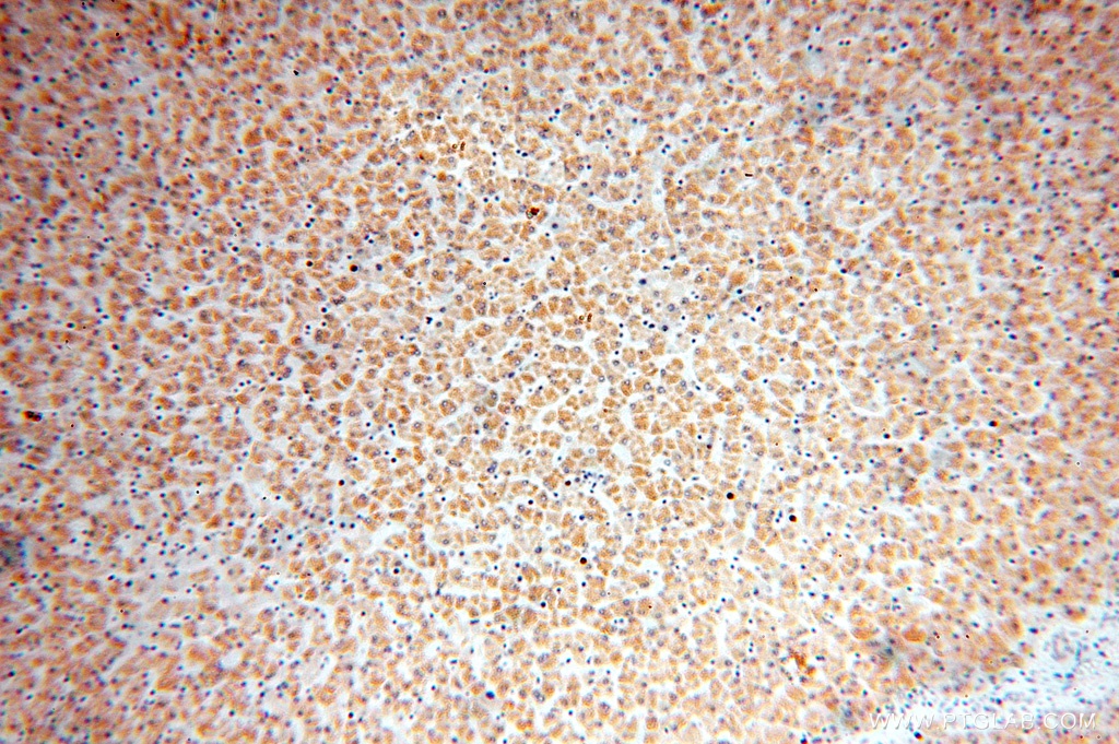 16888-1-AP;human liver